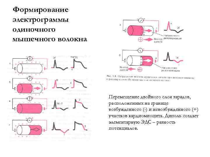 Формирование электрограммы одиночного мышечного волокна Перемещение двойного слоя зарядов, расположенных на границе возбужденного (-)