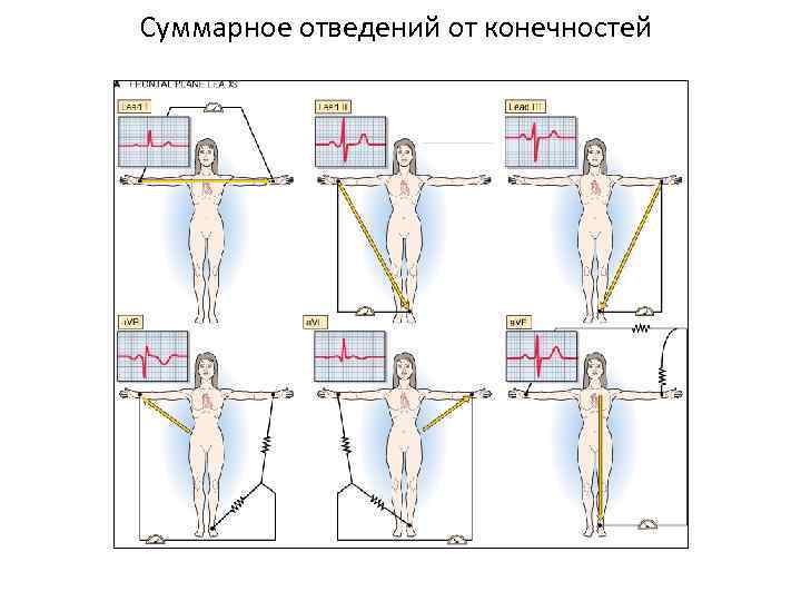 Суммарное отведений от конечностей 