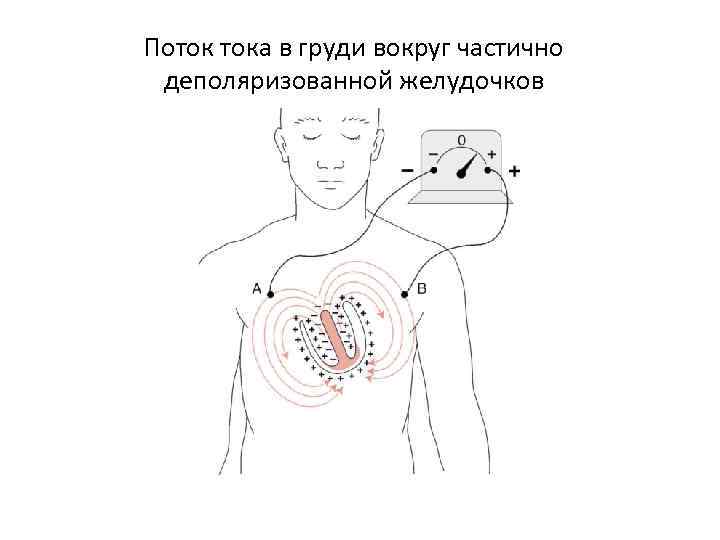 Поток тока в груди вокруг частично деполяризованной желудочков 