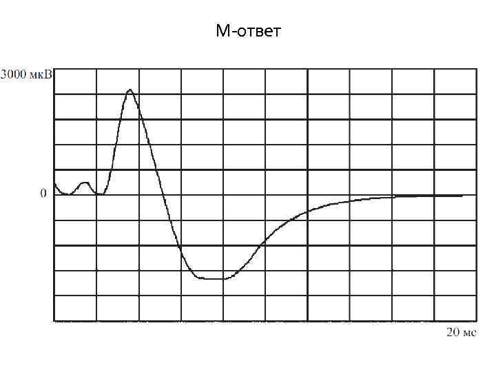 М-ответ 