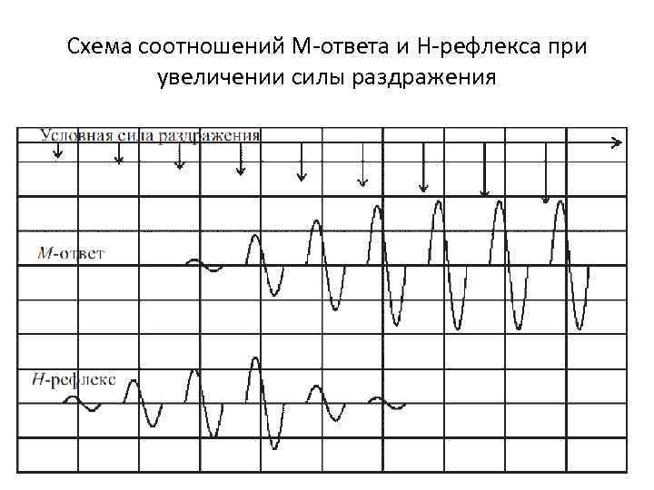 Схема соотношений М-ответа и H-рефлекса при увеличении силы раздражения 