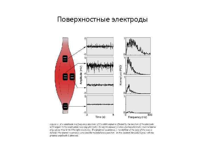 Поверхностные электроды 