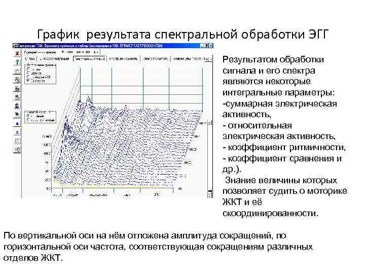 График результата спектральной обработки ЭГГ Результатом обработки сигнала и его спектра являются некоторые интегральные