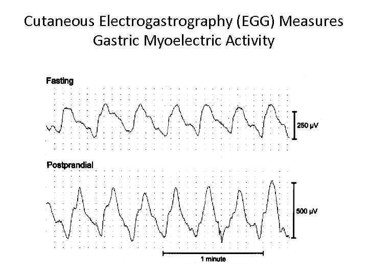 Cutaneous Electrogastrography (EGG) Measures Gastric Myoelectric Activity 