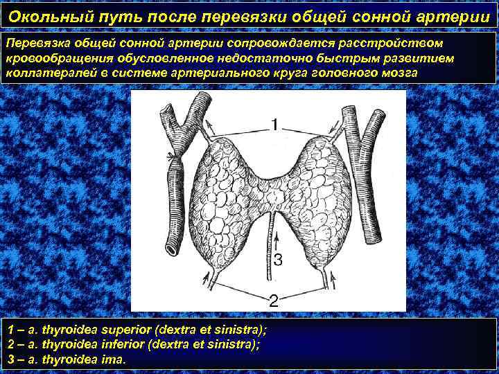 Окольный путь после перевязки общей сонной артерии Перевязка общей сонной артерии сопровождается расстройством кровообращения