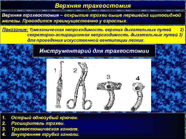 Верхняя трахеостомия – вскрытие трахеи выше перешейка щитовидной железы. Проводится преимущественно у взрослых. Показания: