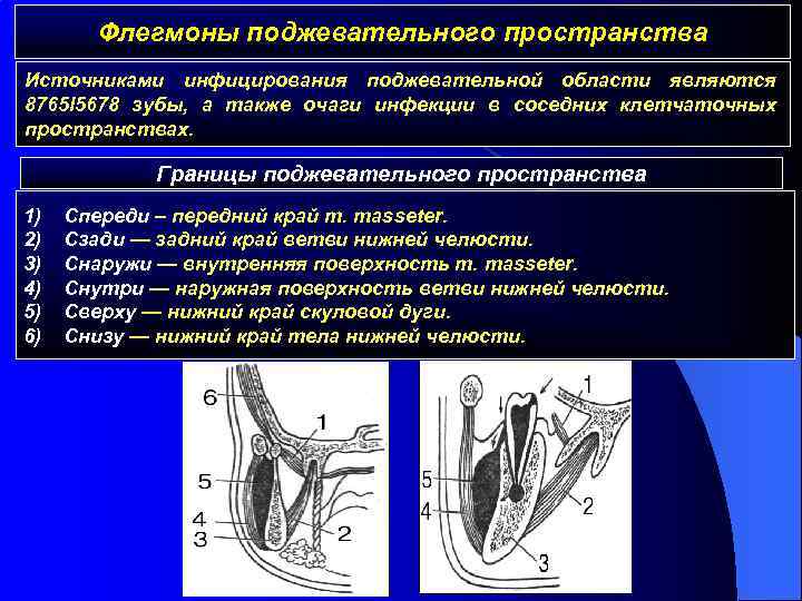 Флегмоны поджевательного пространства Источниками инфицирования поджевательной области являются 8765 l 5678 зубы, а также