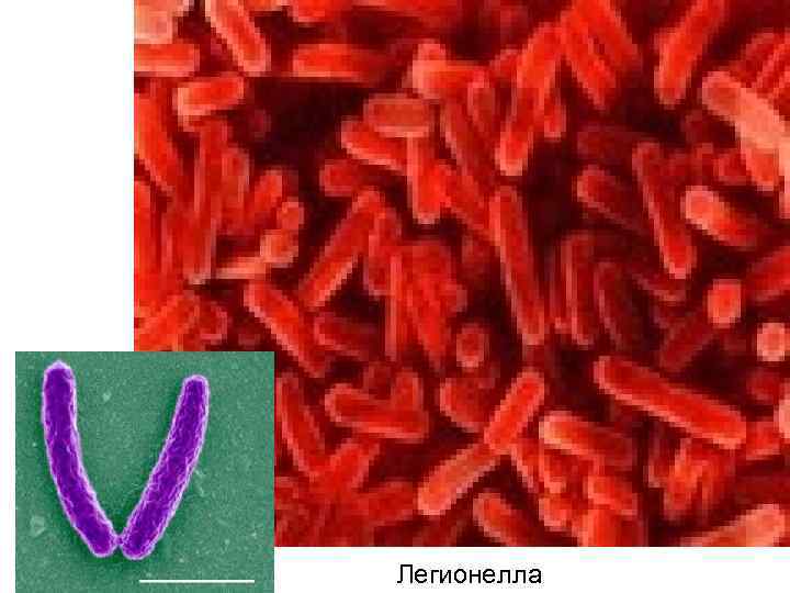 Легионелла 