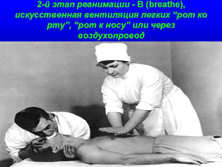 2 -й этап реанимации - В (breathe), искусственная вентиляция легких “рот ко рту”, “рот