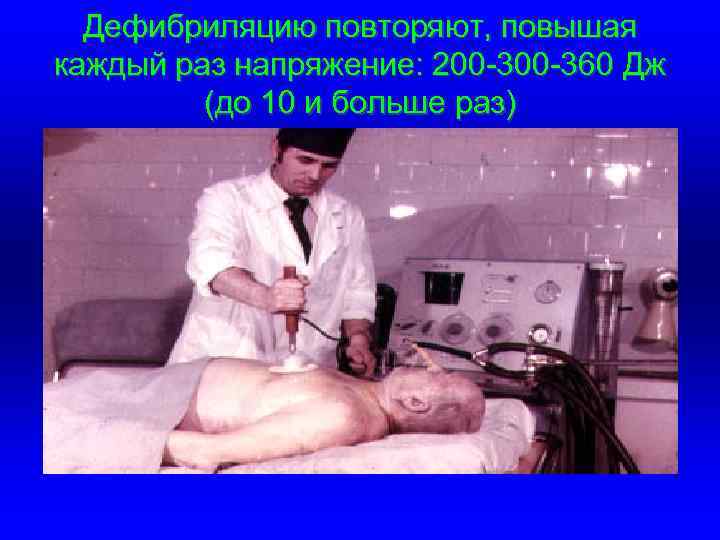 Дефибриляцию повторяют, повышая каждый раз напряжение: 200 -360 Дж (до 10 и больше раз)