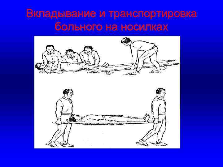 Вкладывание и транспортировка больного на носилках 