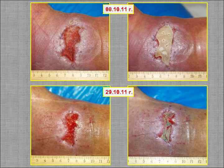 08. 10. 11 г. 29. 10. 11 г. 