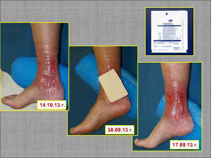 14. 10. 13 г. 30. 09. 13 г. 17. 09. 13 г. 