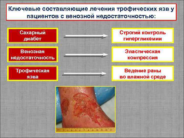 Ключевые составляющие лечения трофических язв у пациентов с венозной недостаточностью: Сахарный диабет Строгий контроль