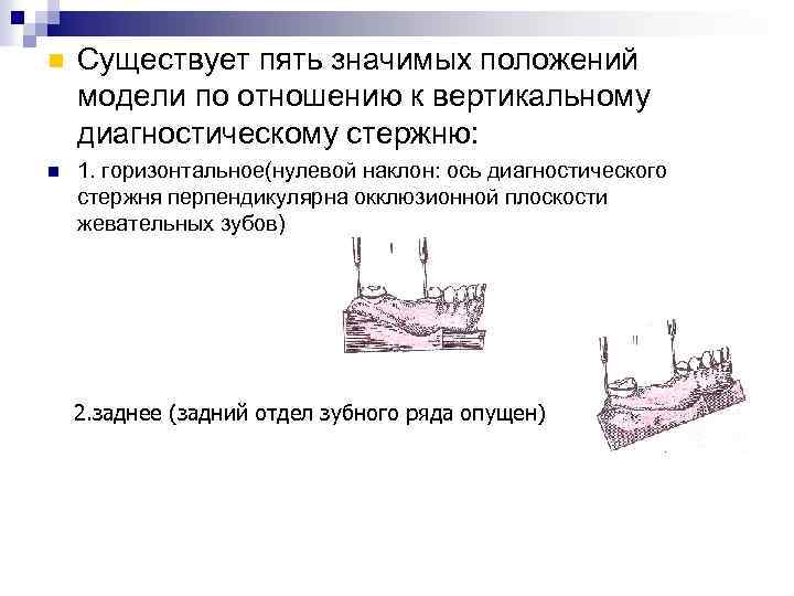 При переднем наклоне модели на столике параллелометра задний край модели