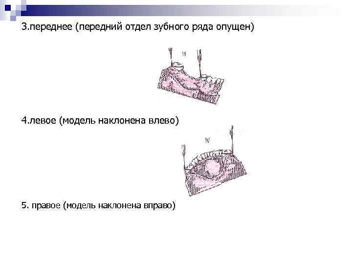 3. переднее (передний отдел зубного ряда опущен) 4. левое (модель наклонена влево) 5. правое