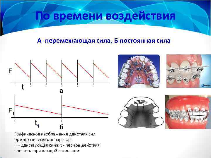 По времени воздействия А- перемежающая сила, Б-постоянная сила Графическое изображение действия сил ортодонтических аппаратов: