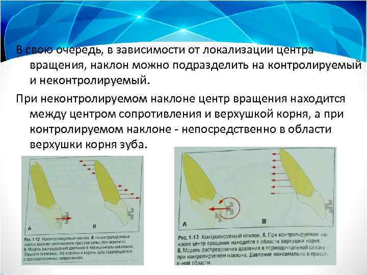 В свою очередь, в зависимости от локализации центра вращения, наклон можно подразделить на контролируемый