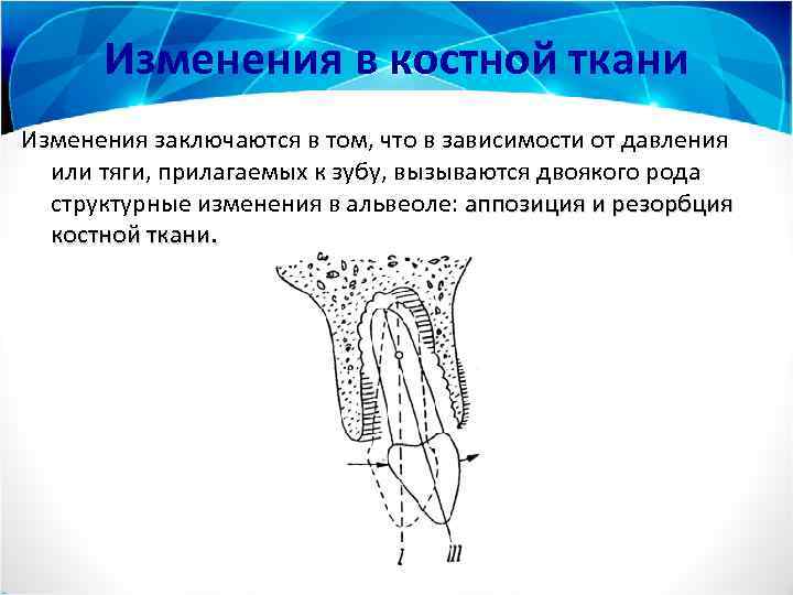 Изменения в костной ткани Изменения заключаются в том, что в зависимости от давления или