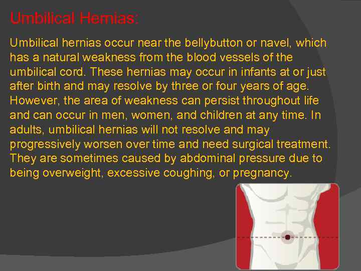 Umbilical Hernias: Umbilical hernias occur near the bellybutton or navel, which has a natural