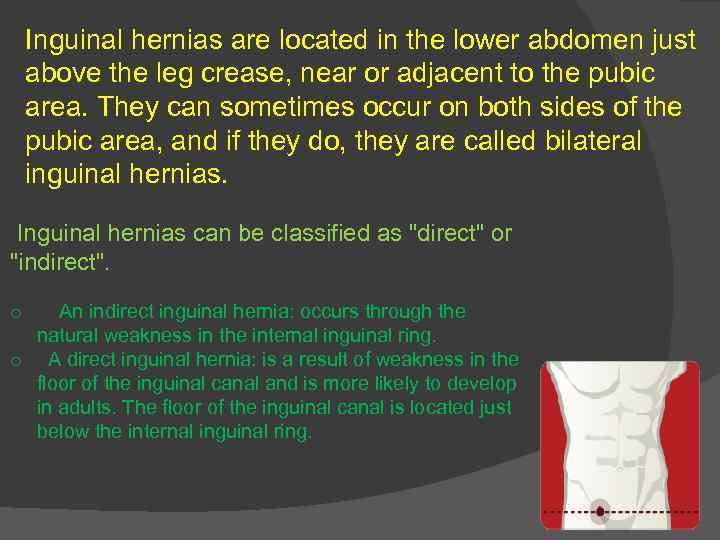Inguinal hernias are located in the lower abdomen just above the leg crease, near