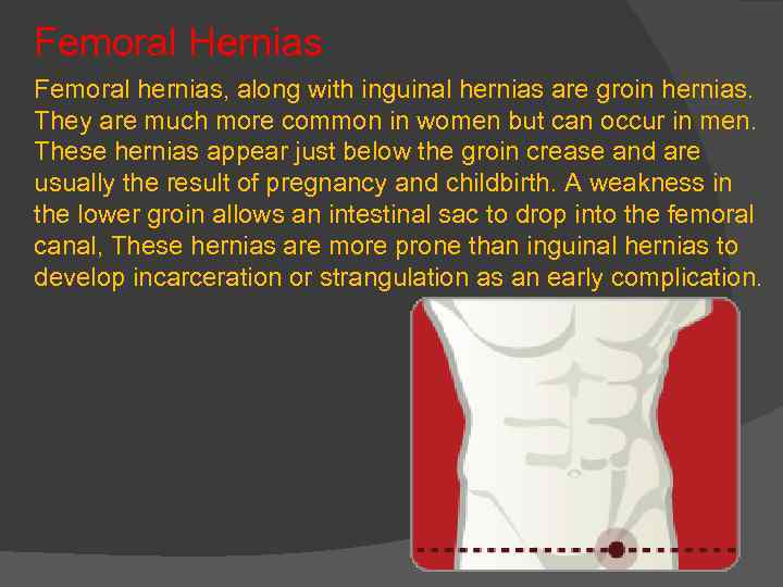 Femoral Hernias Femoral hernias, along with inguinal hernias are groin hernias. They are much