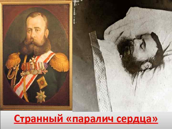 Странный «паралич сердца» 