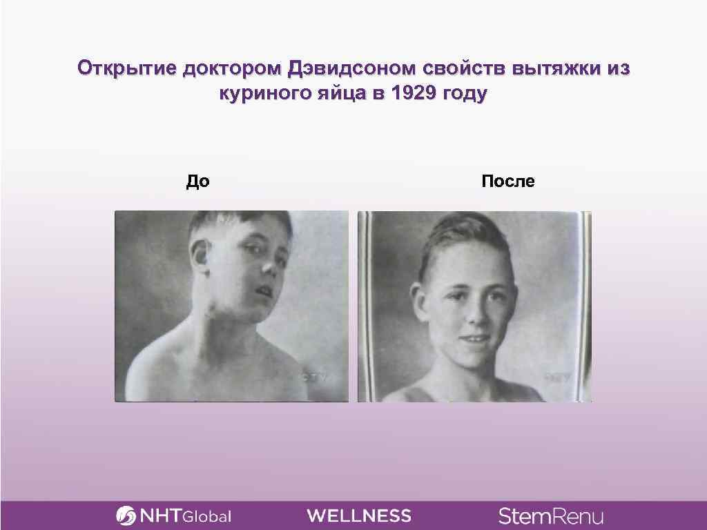 Открытие доктором Дэвидсоном свойств вытяжки из куриного яйца в 1929 году До После 