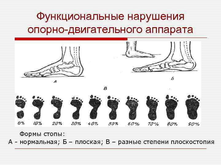 Форма стопы. Опорно двигательный аппарат стопы. Возрастная анатомия опорно-двигательного аппарата. Нарушение формы стопы.