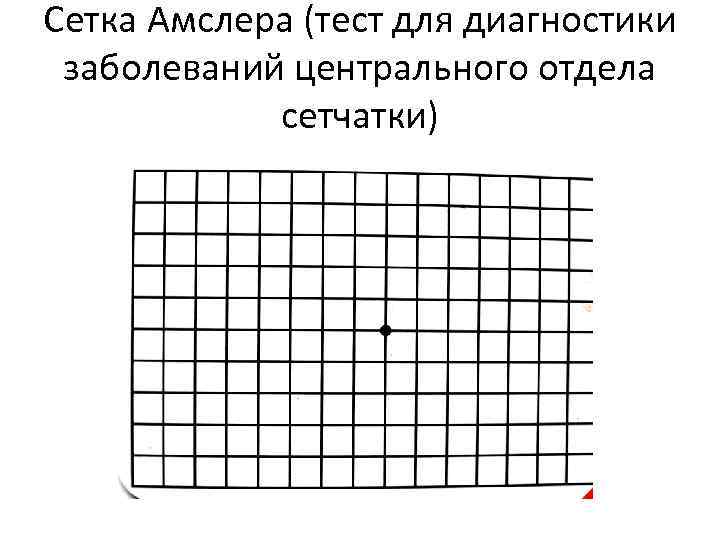 Сетка Амслера (тест для диагностики заболеваний центрального отдела сетчатки) 