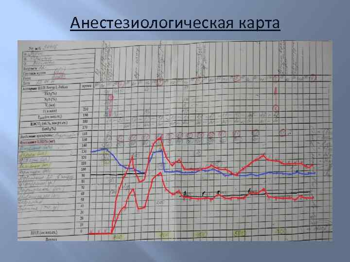 Анестезиологическая карта 