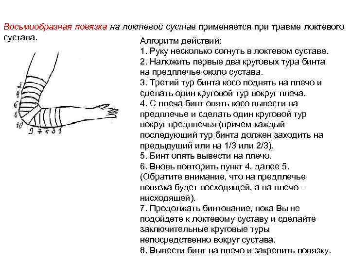 Повязка на локоть. Черепашья повязка на локтевой сустав алгоритм. Черепашья сходящаяся на локтевой сустав алгоритм. Техника наложения повязки на локтевой сустав алгоритм. Наложение спиральной повязки на локтевой сустав.