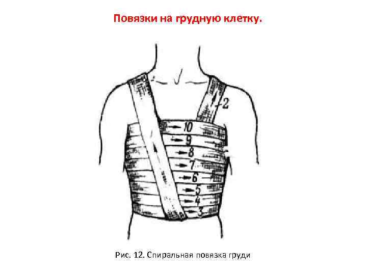 Спиральная повязка