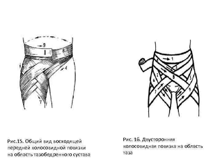 Перевязка ягодицы. Колосовидная повязка на тазобедренный сустав алгоритм. Колосовидная повязка на паховую область. Колосовидная повязка тазобедренного сустава и бедра.