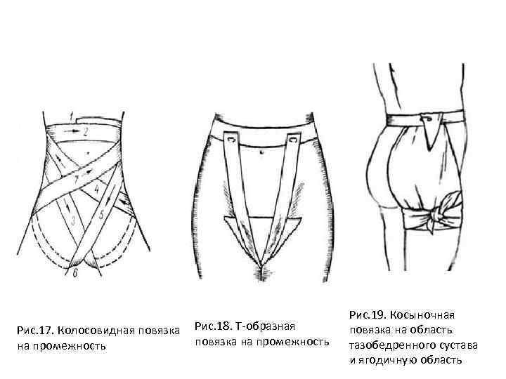 Неоперативная хирургическая техника десмургия презентация