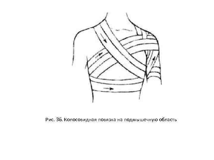 Неоперативная хирургическая техника десмургия презентация