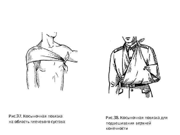 Косыночная повязка схема