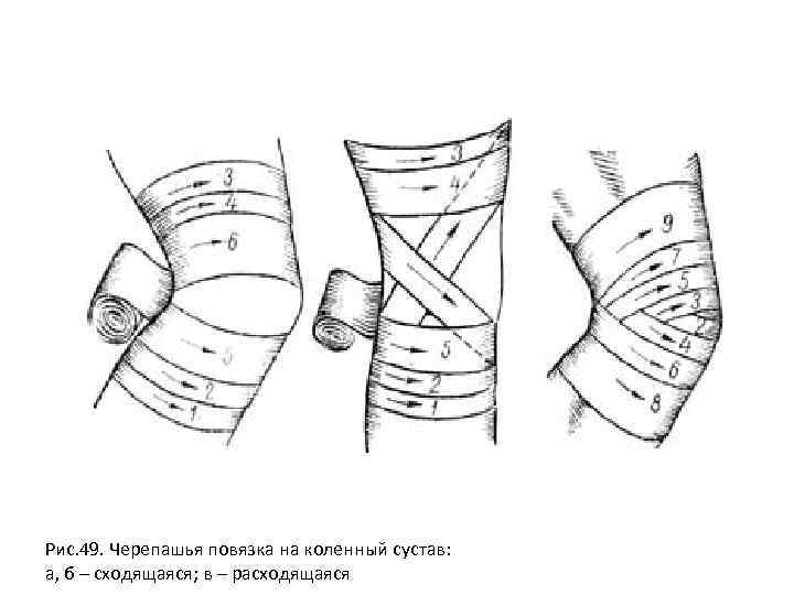 Неоперативная хирургическая техника десмургия презентация