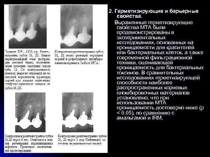 2. Герметизирующие и барьерные свойства. Выраженные герметизирующие свойства МТА были продемонстрированы в экспериментальных исследованиях,