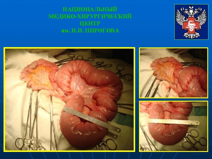 НАЦИОНАЛЬНЫЙ МЕДИКО-ХИРУРГИЧЕСКИЙ ЦЕНТР им. Н. И. ПИРОГОВА 