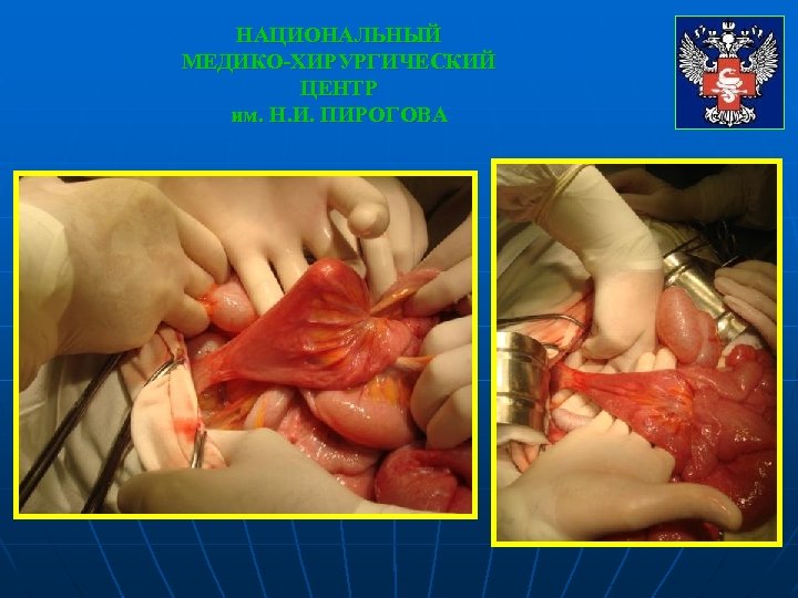 НАЦИОНАЛЬНЫЙ МЕДИКО-ХИРУРГИЧЕСКИЙ ЦЕНТР им. Н. И. ПИРОГОВА 