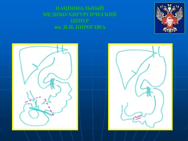НАЦИОНАЛЬНЫЙ МЕДИКО-ХИРУРГИЧЕСКИЙ ЦЕНТР им. Н. И. ПИРОГОВА 