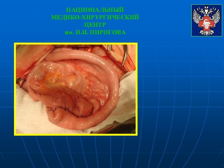 НАЦИОНАЛЬНЫЙ МЕДИКО-ХИРУРГИЧЕСКИЙ ЦЕНТР им. Н. И. ПИРОГОВА 