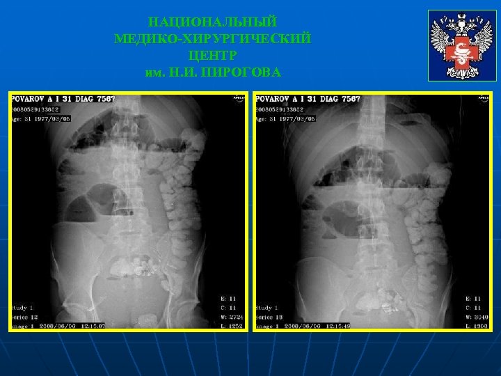 НАЦИОНАЛЬНЫЙ МЕДИКО-ХИРУРГИЧЕСКИЙ ЦЕНТР им. Н. И. ПИРОГОВА 