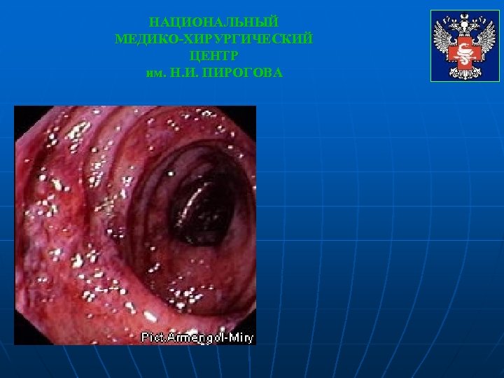 НАЦИОНАЛЬНЫЙ МЕДИКО-ХИРУРГИЧЕСКИЙ ЦЕНТР им. Н. И. ПИРОГОВА 