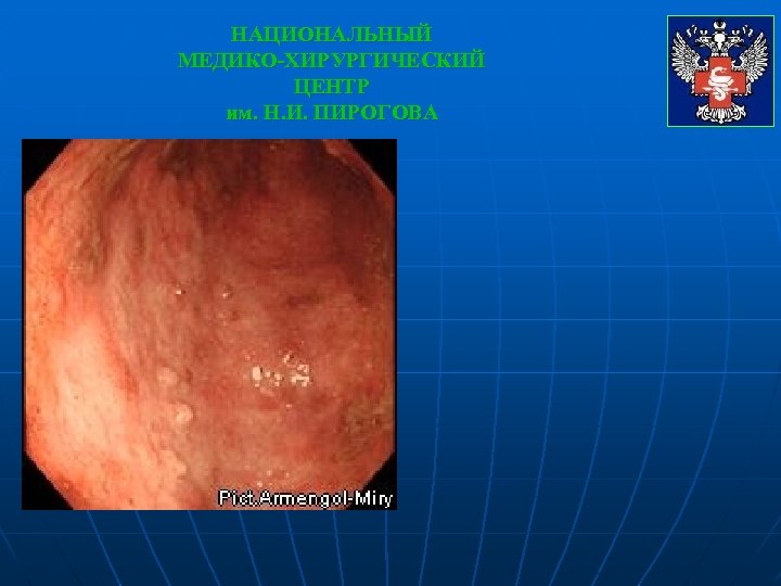 НАЦИОНАЛЬНЫЙ МЕДИКО-ХИРУРГИЧЕСКИЙ ЦЕНТР им. Н. И. ПИРОГОВА 