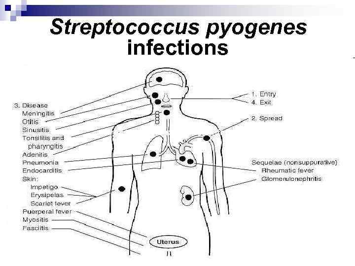 Streptococcus pyogenes infections 