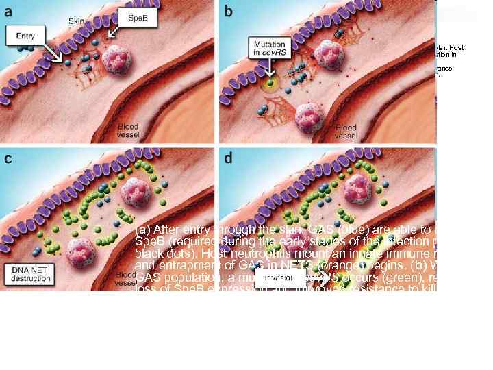 (a) After entry through the skin, GAS (blue) are able to express Spe. B