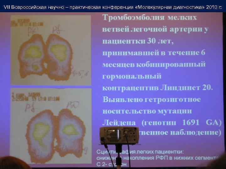 VII Всероссийская научно – практическая конференция «Молекулярная диагностика» 2010 г: 