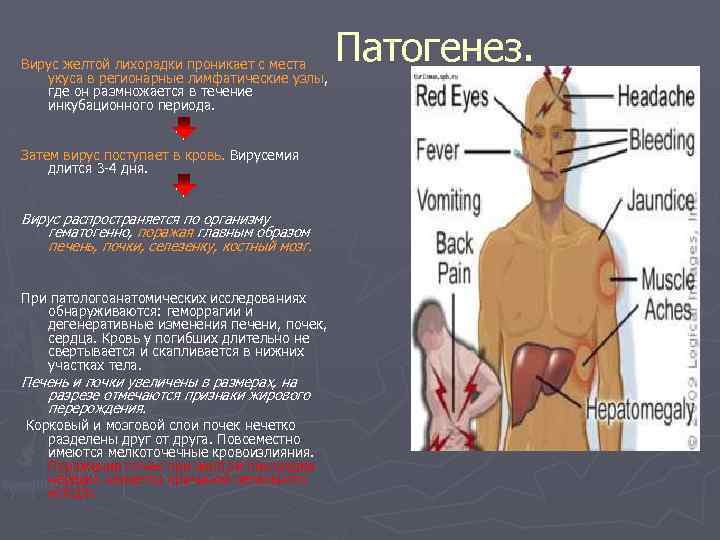  Патогенез. Вирус желтой лихорадки проникает с места укуса в регионарные лимфатические узлы, где